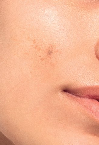 02 Before After Asell Mobile